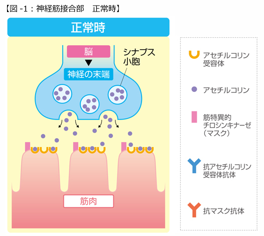 症 無力 重症 筋力