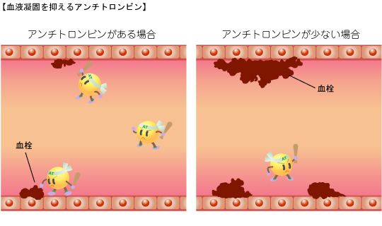 血液凝固を抑えるアンチトロンビン