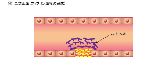 ４．二次止血（フィブリン血栓の完成）