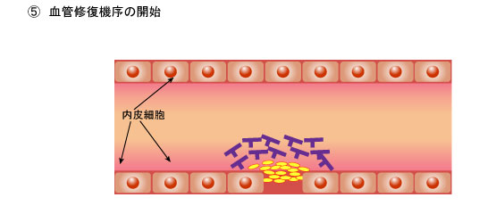 ５．血管修復機序の開始