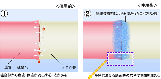 組織接着剤の仕組み（図解）