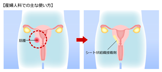 （４）産婦人科での使い方