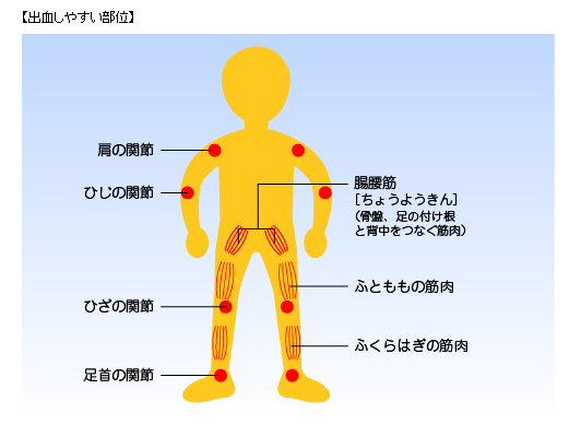 出血しやすい部位