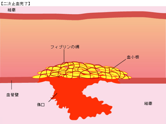 二次止血完了