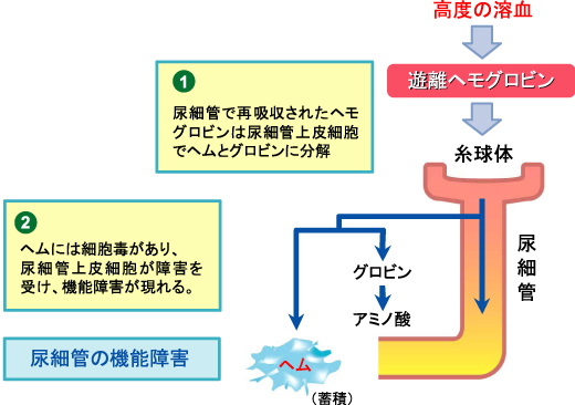 メト ヘモグロビン