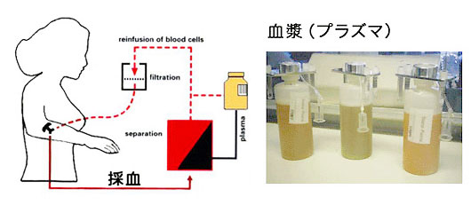 採血とプラズマフェレーシスとは？